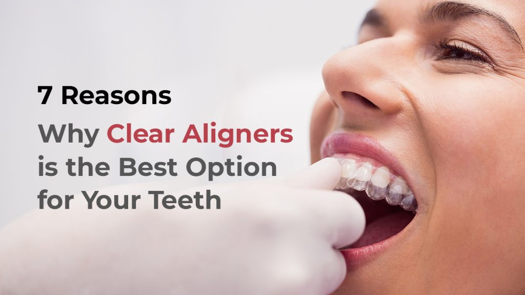 Reason why clear aligners are best option