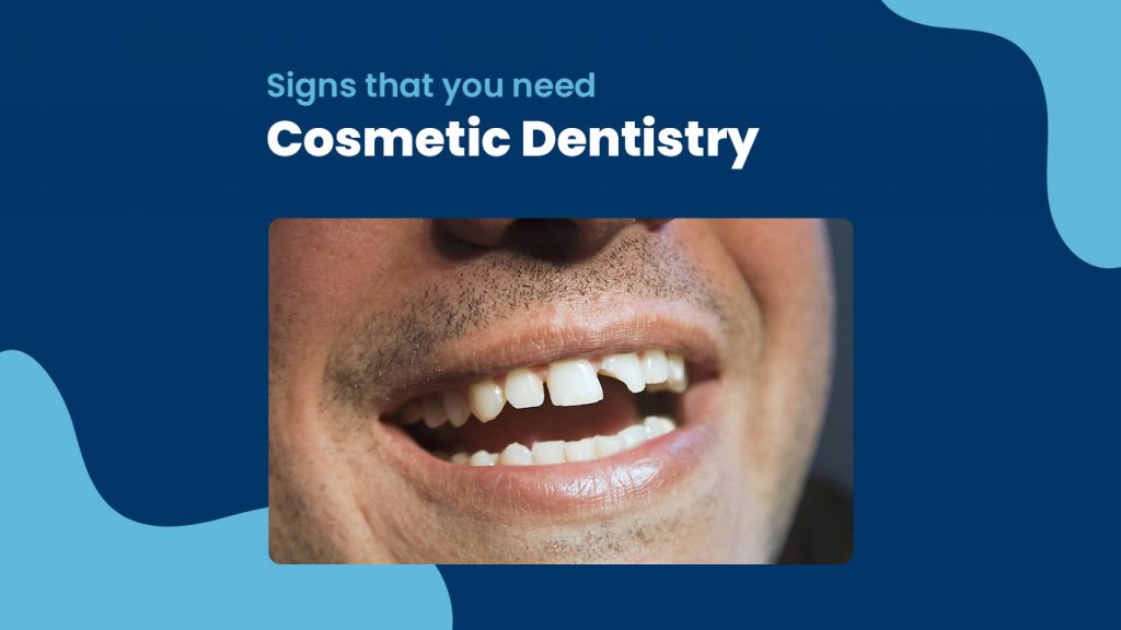 signs that you need cosmetic dentistry