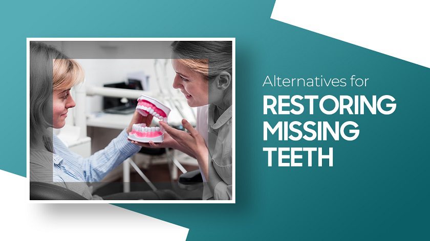 Alternatives for Restoring Missing Teeth