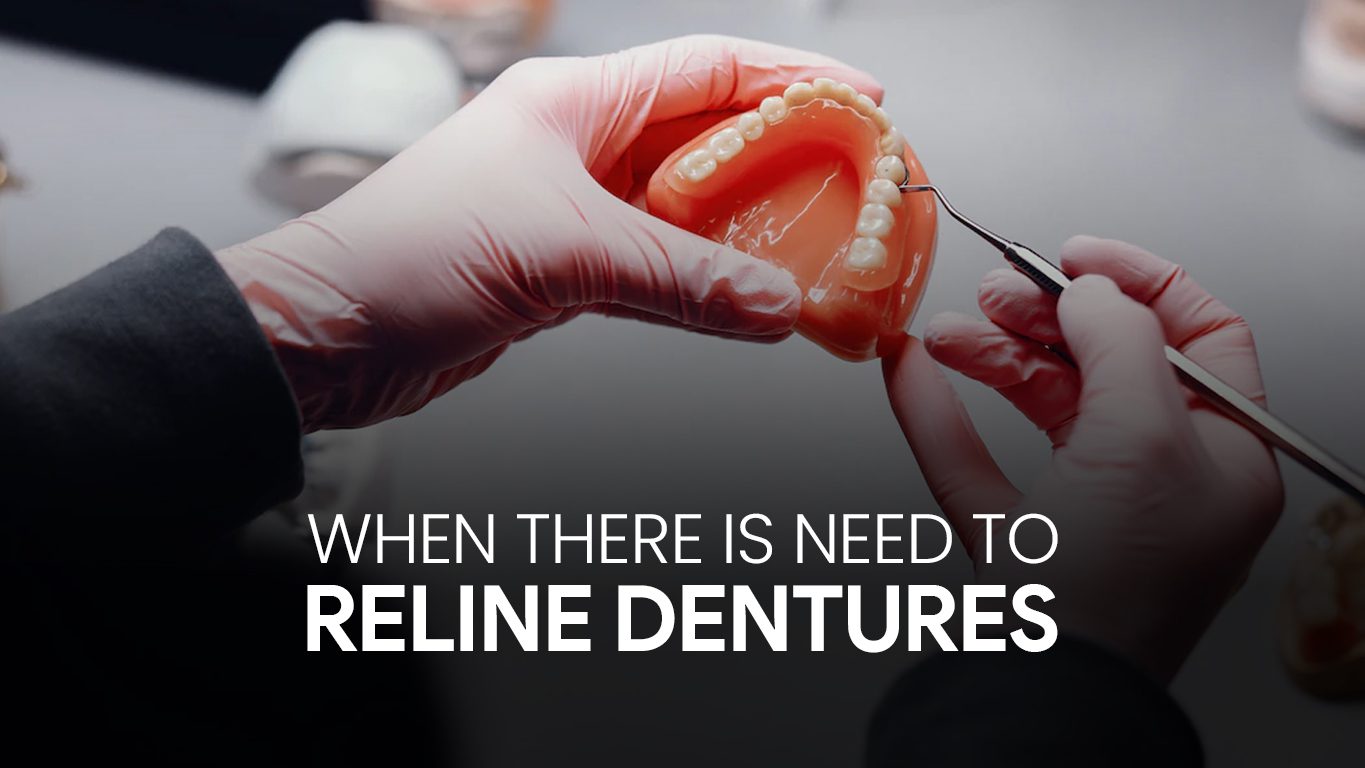 Reline Dentures
