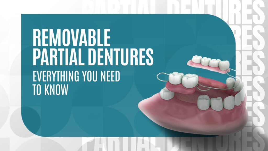 Illustration of removable partial dentures